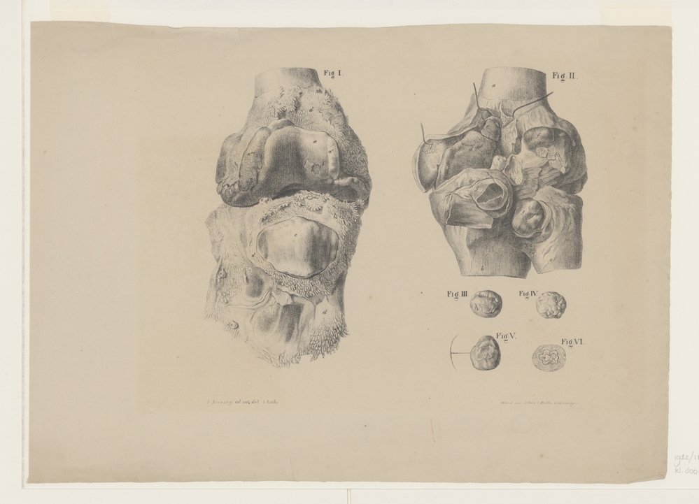 Anatomische tekening van gewrichten