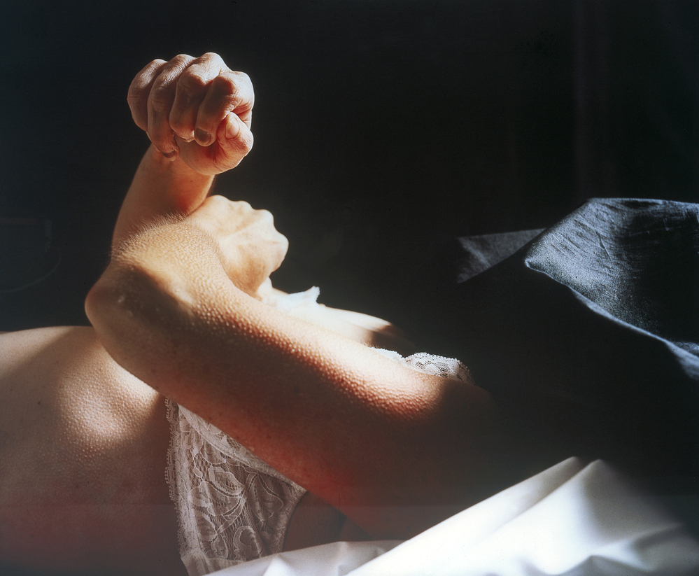 The Morgue (Rat Poison Suicide)