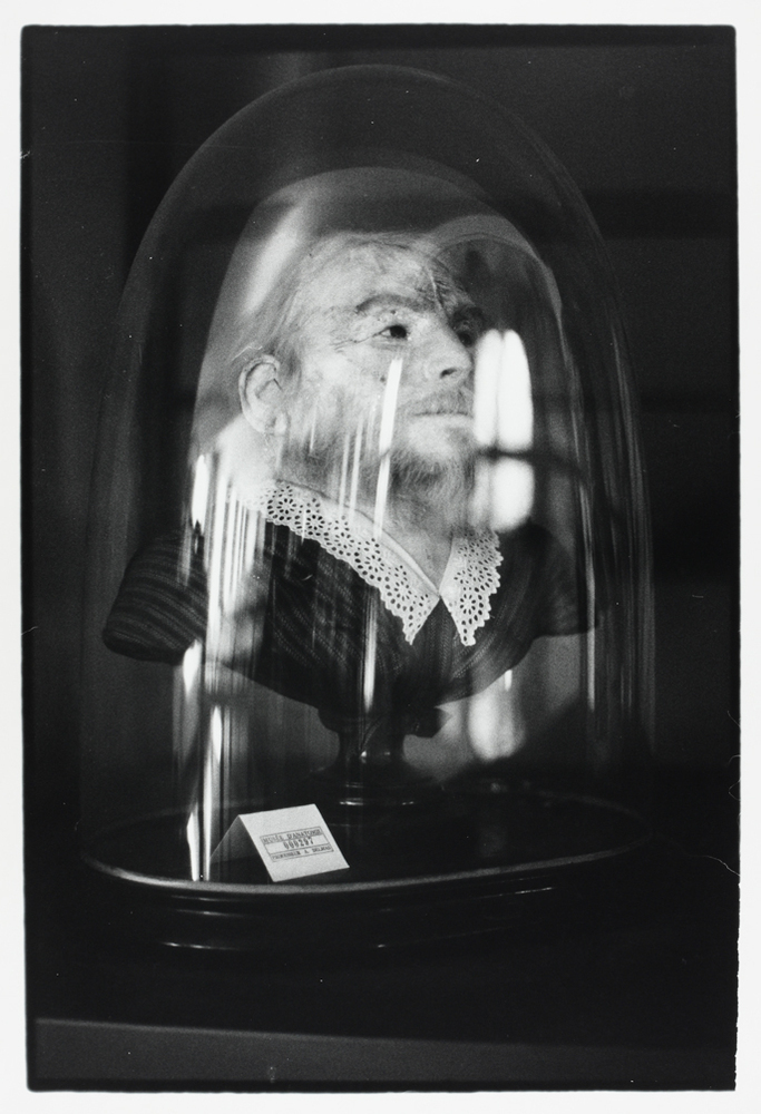 Preserved head of a bearded woman, Musée Orfila